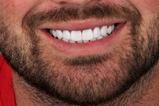 Slider image (4) Bright Way Dental Clinic